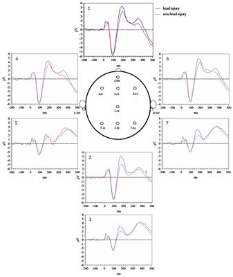 Head Injury Exposure in Veterans Presenting to Memory Disorders Clinic: An Observational Study of Clinical Characteristics and Relationship of Event-Related Potentials and Imaging Markers